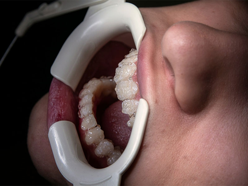 Rotary Endodontics in Willimantic