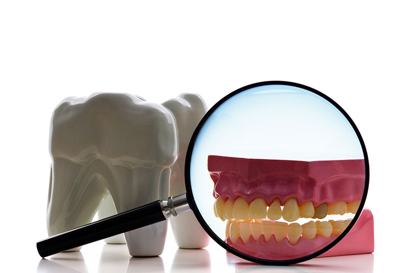 Root Canals in Willimantic