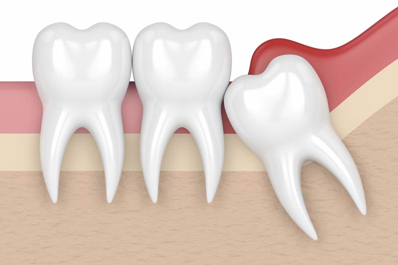 General Dentistry in Willimantic