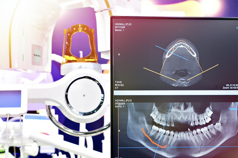 Digital X-Rays in Willimantic